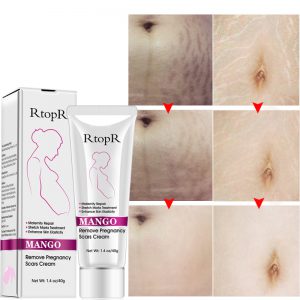 Pregnancy Cream Mango Remove Repair Suitable For Any Shin Type